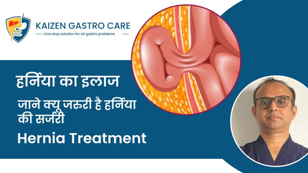 Hernia Surgery In Pune Best Hernia Specialist In Pune Kaizen Gastro Care