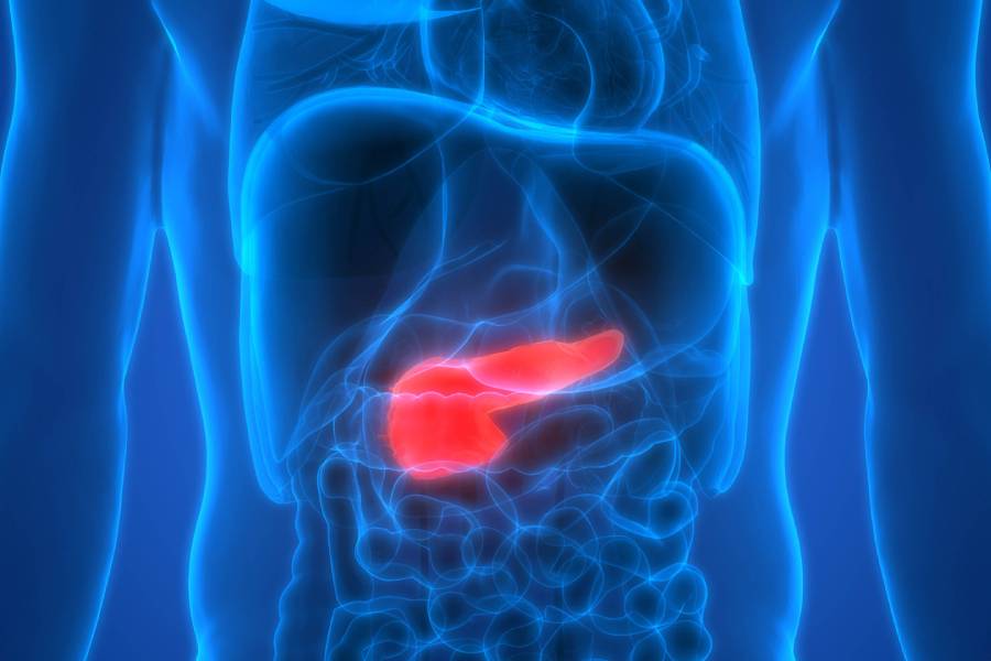 Pancreatic Cancer Treatment in Pune- Kaizen Gastro Care
