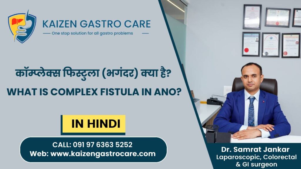 Fistula Specialist In Pune Fistula Treatment In Pune Kaizen Gastro Care 0867