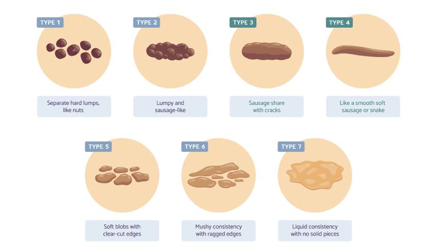 Bristol Stool Chart: The 7 Different Types of Poop - GoodRx