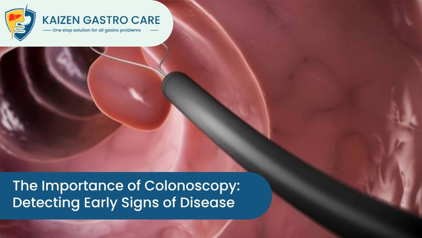 The Importance of Colonoscopy: Detecting Early Signs of Disease