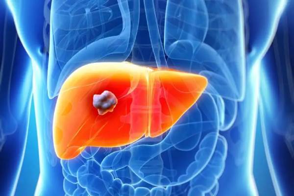 Liver Abscess Treatment in Pune- Kaizen Gastro Care