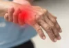 Early Signs of Guillain-Barré Syndrome: What You Need to Know